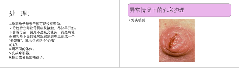 教育培训母乳喂养知识讲座母乳PPT模板-19