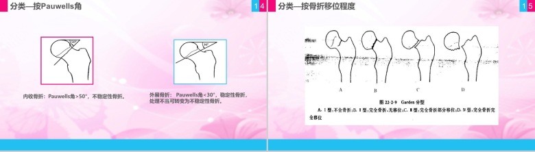 股骨颈骨折护理查房课件PPT模板-8