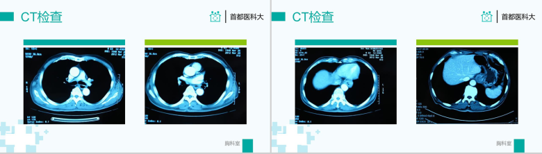 医院病历汇报述职报告PPT模板-5