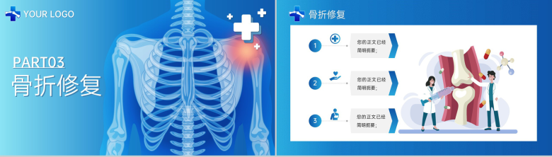 蓝色简洁骨科医生治疗研究报告医学论文答辩PPT模板-8